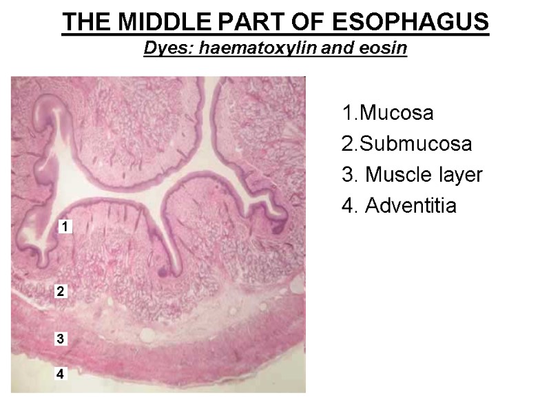 THE MIDDLE PART OF ESOPHAGUS  Dyes: haematoxylin and eosin  1.Mucosa 2.Submucosa 3.